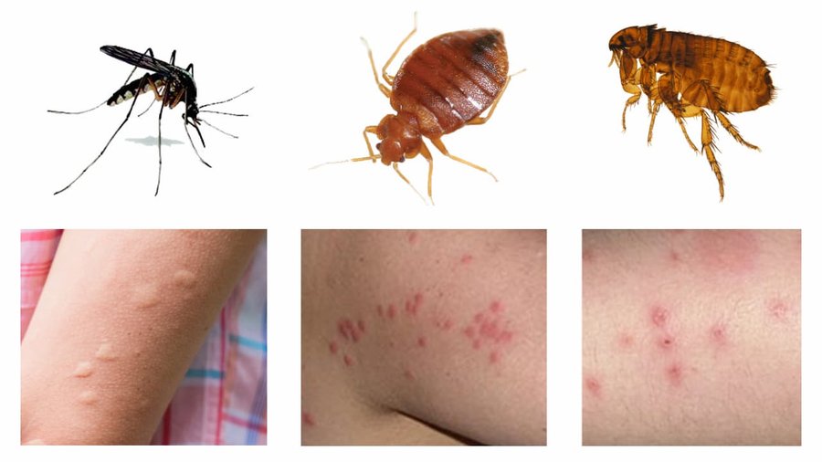 Comparaison des piqûres de puce, punaise de lit et moustique.